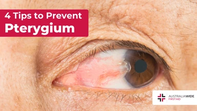 Prevent pterygium article header – First Aid Article in Casuarina